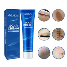 Load image into Gallery viewer, Skin Repair Cream Scar Cream Care for Scalds Burn Marks Acne Marks Fading and Smoothing Care Cream Scar Cream
