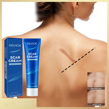 Load image into Gallery viewer, Skin Repair Cream Scar Cream Care for Scalds Burn Marks Acne Marks Fading and Smoothing Care Cream Scar Cream

