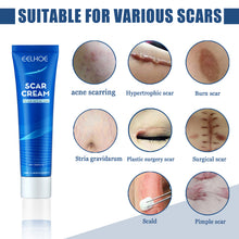Load image into Gallery viewer, Skin Repair Cream Scar Cream Care for Scalds Burn Marks Acne Marks Fading and Smoothing Care Cream Scar Cream
