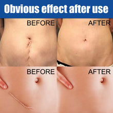 Load image into Gallery viewer, Skin Repair Cream Scar Cream Care for Scalds Burn Marks Acne Marks Fading and Smoothing Care Cream Scar Cream
