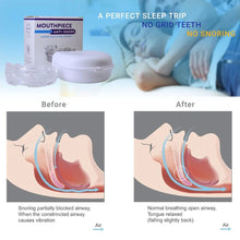 Load image into Gallery viewer, Anti Snoring Bruxism Mouth Guard Improve Sleeping Teeth Bruxism Sleeping Anti Snoring and Apnea Snoring Device To Stop Snoring
