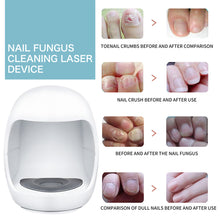 Load image into Gallery viewer, Gray Nail Care Device Gray Nail Fungus Cleaning and Care Device Mini Onychomycosis Treatment Fungal Nail Laser Device
