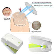 Load image into Gallery viewer, Blue Light Pulse Nails Feet Nail Fungus Laser Nail Therapy Device Foot Care Removal Device Fingernail Therapy Onychomycosis Treatment Device
