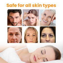 Load image into Gallery viewer, Anti Wrinkle Patch on Forehead Desalinates Smoothes Wrinkles on Forehead Tightens and Lifts Facial Skin Wrinkle Removing Patches
