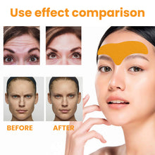 Load image into Gallery viewer, Anti Wrinkle Patch on Forehead Desalinates Smoothes Wrinkles on Forehead Tightens and Lifts Facial Skin Wrinkle Removing Patches
