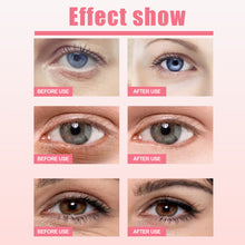 Load image into Gallery viewer, Rose Fruit Eye Cream Stick Reduces Eye Bags Fine Lines Moisturizes and Tightens The Skin Around The Eyes Skin Care
