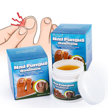 Load image into Gallery viewer, Nail Fungus Ointment Remove Paronychia Eliminate Ingrown Nail Moisturize Skin Repair Toenails Foot Care Cream Health Care

