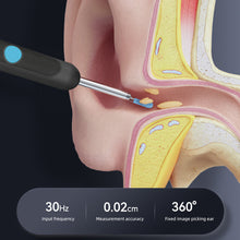 Load image into Gallery viewer, High-definition Intelligent Visual Ear Digging Spoon Wireless Rechargeable Luminous Ear Cleaner Ear Wax Removal Tool Ear Care
