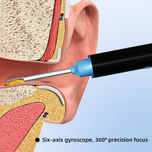 Load image into Gallery viewer, Wireless Intelligent Visual Ear Digging Spoon High-definition Rechargeable Luminous Ear Spoon Ear Wax Removal Tool Household Ear Cleaner
