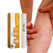Load image into Gallery viewer, Varicose Vens Pen Repair Vasculitis Phlebitis Soothe Skin Relieve Varicose Feet Blood Vessel Blockage Body Health Care
