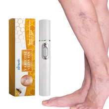 Load image into Gallery viewer, Varicose Vens Pen Repair Vasculitis Phlebitis Soothe Skin Relieve Varicose Feet Blood Vessel Blockage Body Health Care
