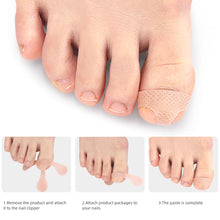 Load image into Gallery viewer, T-shaped Nail Sticker Ingrown Toenail Correction Patch Elastic Stretch Paronychia Inlaid Nail Restoration Patch Nail Care Tool
