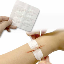Load image into Gallery viewer, 3Pcs/set Band-Aid Zipper Tie Wound Closure Patch Hemostatic Patch Wound Fast Suture Zipper Band-Aid Outdoor Portable
