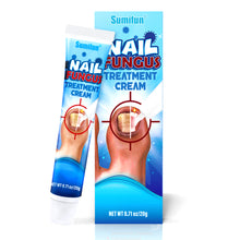 Load image into Gallery viewer, Mild Onychomycosis Cream Onychomycosis Care Repair Cream Toenail Onychomycosis Cream Nail Care Cream Health Care
