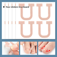 Load image into Gallery viewer, U-shaped Nail Stickers Paronychia Ingrown Toenail Correction Patches Elastic Stretching Onychocryptosis Restoration Patches

