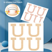 Load image into Gallery viewer, U-shaped Nail Stickers Paronychia Ingrown Toenail Correction Patches Elastic Stretching Onychocryptosis Restoration Patches
