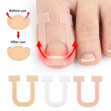 Load image into Gallery viewer, U-shaped Nail Stickers Paronychia Ingrown Toenail Correction Patches Elastic Stretching Onychocryptosis Restoration Patches
