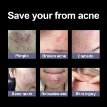 Load image into Gallery viewer, Cartoon Acne Patch Cute Cat Claw Ice Cream Pe Acne Patch Portable Shaped Acne Patch
