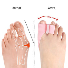 Load image into Gallery viewer, SEBS Side Wear-resistant Double Hole Toe Separator Thumb Valgus Corrector Washable Reusable Big Foot Bone Overlap Toe Separator
