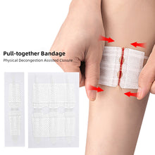Load image into Gallery viewer, Suture Free Latches Pull-together Self-adhesive Bandage Independent Packaging Non-woven Elastic Band Bandage Wound Care
