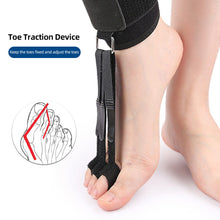 Load image into Gallery viewer, Toe Tractor Bigfoot Bone Overlapping Toe Separator Comfortable Adjustable Cone-toe Toe-bending Orthotics Toe Adjusting Foot Guard
