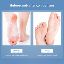 Load image into Gallery viewer, 3-in-1 Stainless Steel Foot Grinder Exfoliating Foot Callus Remover Foot File Washable Durable Manual Home Foot Care Tool
