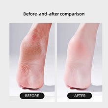 Load image into Gallery viewer, U-shaped Foot Scrubber Foot Grinder Remove Dead Skin Calluses Household Pedicure Foot Grinder Foot Sander Foot Skin Polishing Tool
