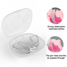 Load image into Gallery viewer, Anti Snoring Corrector Snoring Artifact Women Anti Snoring Device Nasal Clip Men Sleeping At Night
