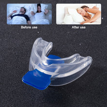 Load image into Gallery viewer, Silicone Mouth Containing Anti Snoring and Anti Snoring Device Night Time Mouth Guard Anti Snoring Device Anti Snoring Tooth Cover
