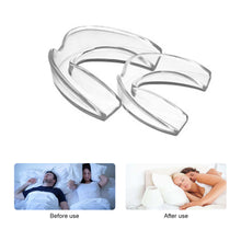 Load image into Gallery viewer, Night Time Anti Grinding and Anti Snoring Dental Braces Made of Moldable Material for Tooth Protection and Braces Set
