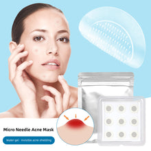 Load image into Gallery viewer, Soluble Microneedle Hydrocolloid Acne Patch Waterproof Invisible Breathable Acne Patch Available Day And Night Skin Care Repair Patch
