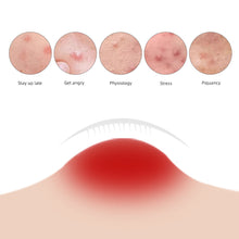Load image into Gallery viewer, Soluble Microneedle Hydrocolloid Acne Patch Waterproof Invisible Breathable Acne Patch Available Day And Night Skin Care Repair Patch
