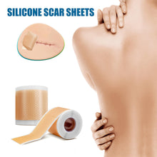 Load image into Gallery viewer, 1 Roll 40MM*1.5M Gel Scar Patch Inhibit Scar Hyperplasia TPU Waterproof Stretch Mark Care Strips
