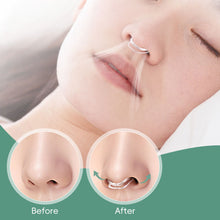 Load image into Gallery viewer, Nose Clip Anti-snoring Device Sleep Anti-opening Mouth Anti-snoring Physical Closure Nose Clip Increase Breathing Air Circulation

