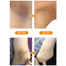 Load image into Gallery viewer, Armpit Cream Moisturizing Improving Skin Dullness Shrinking Pores Underarm Whitening Brightening Cream Body Care Cream
