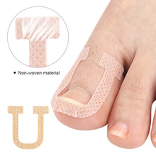 Load image into Gallery viewer, 10sheets Nail Correction Stickers Ingrown Toenail Corrector Patches Treatment Recover Corrector Pedicure Care Tool
