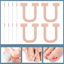 Load image into Gallery viewer, 10sheets Nail Correction Stickers Ingrown Toenail Corrector Patches Treatment Recover Corrector Pedicure Care Tool
