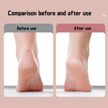 Load image into Gallery viewer, Household Automatic Electric Foot Grinder Double Gear Callus Remover Detachable Washable Exfoliating Foot Grinder
