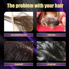 Load image into Gallery viewer, Hair Shampoo for Fast Hair Growth Rosemary Onion Shampoo Spray Anti Hair Loss Effective Within 7 Day Hair Growth Product
