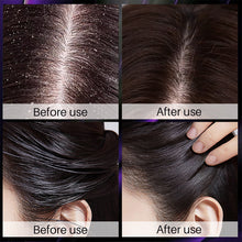 Load image into Gallery viewer, Hair Shampoo for Fast Hair Growth Rosemary Onion Shampoo Spray Anti Hair Loss Effective Within 7 Day Hair Growth Product
