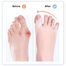 Load image into Gallery viewer, 1Pair Silicone Gel Foot Toe Separator Breathable Thumb Hallux Valgus Splint Thumb Orthopedic Braces Correct
