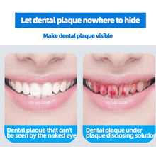 Load image into Gallery viewer, Dental Plaque Detector Solution Oral Hygiene Indicator detection Dentist-Recommended Oral Care Educational Tool
