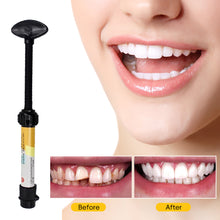 Load image into Gallery viewer, Portable Temporary Tooth Filling Kit Tooth Cap Repair Quick Emergency Dental Repair Putty for Cavities Dental Health Tool Home Use
