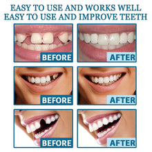 Load image into Gallery viewer, Portable Temporary Tooth Filling Kit Tooth Cap Repair Quick Emergency Dental Repair Putty for Cavities Dental Health Tool Home Use
