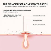 Load image into Gallery viewer, 200Pcs Repair Acne Patches Fade Blemishes Pimple Marks Closed Acne Blemishes Hydrocolloid Star Heart Shaped Cover Acne Pimple Patch
