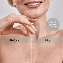 Load image into Gallery viewer, Sleep Chest Pillow Anti-Wrinkle Prevent Reduce Chest Wrinkle Lines Overnight Skincare Home Relaxation Body Shaping Care Pads Sleep Beauty Accessories
