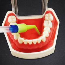 Load image into Gallery viewer, Dental Spittle Aspirator Replacement Heads Mouth Suction Tube Saliva Ejector Accessories Oral Dental Hygiene Supplies
