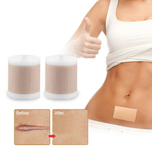 Load image into Gallery viewer, Medical-Grade Silicone Gel Sheet for Fades Superficial Scars Scar Tape for Keloid Removal Patch Breathable Body Care For Burn
