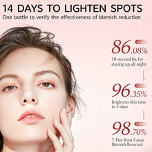 Load image into Gallery viewer, Nicotinamide Facial Serum Melanin Removal Reduce Dark Spots Even Skin Tone Brightening Rejuvenation Anti Acne Face Essence 30ml

