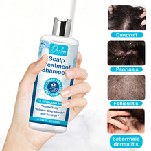 Load image into Gallery viewer, Anti-Dandruff Shampoo 300ml Deep Clarifying Shampoo Non-greasy Repair Hair Clippings Remove Greasy Hair Dense Foam Deep Cleanses Hair
